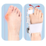 Вальгусный ортез - шина на большой палец стопы от Hallux Valgus серый (ІІ) 34321