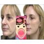 Силиконовый  тренажер для коррекции и подтяжки лица, кожи Jawline Shaper дыхательные упражнения ртом для мышц лица, удаление морщин Розовый(II) 20741