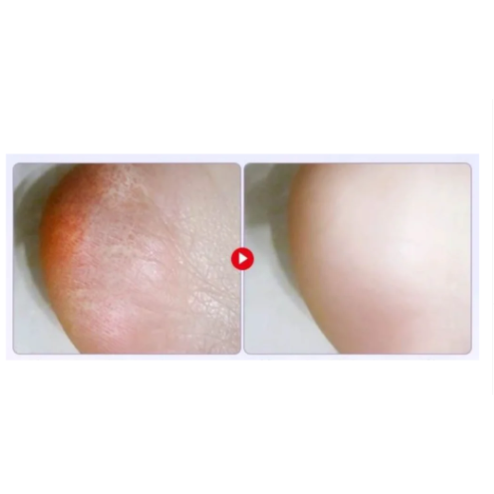 Пилинг маска для ног Horse Oil Soft Exfoliating отшелушивающая 40г Gebaolian (II) 31934