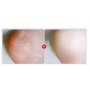Пилинг маска для ног Horse Oil Soft Exfoliating отшелушивающая 40г Gebaolian (II) 31934